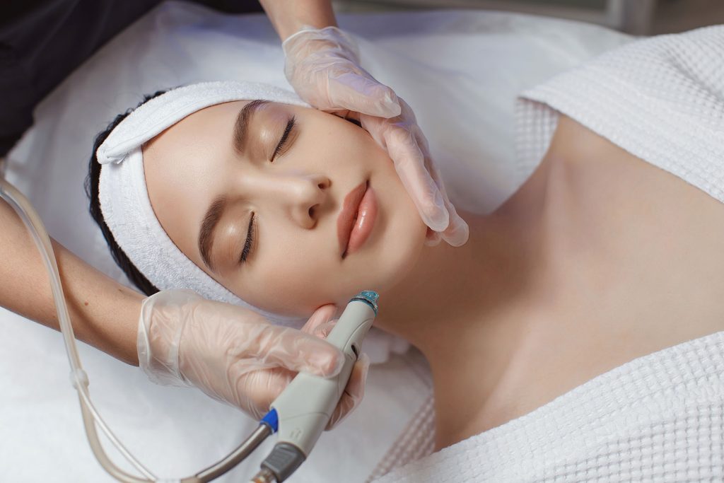 Microdermabrasion